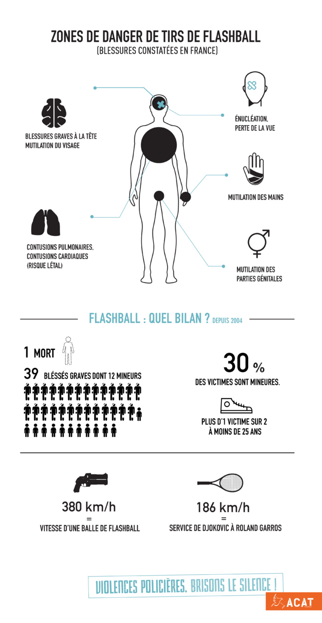 Una ONG francese dinunzia l'utilizazione di u Flash-Ball è l'impunità di a pulizza Una ONG francese dinunzia l'utilizazione di u Flash-Ball è l'impunità di a pulizza